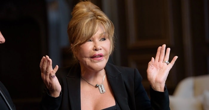 Jocelyn Wildenstein Plastic Surgery Was A Disaster | Surgery Fails